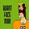 Burnt Face Man